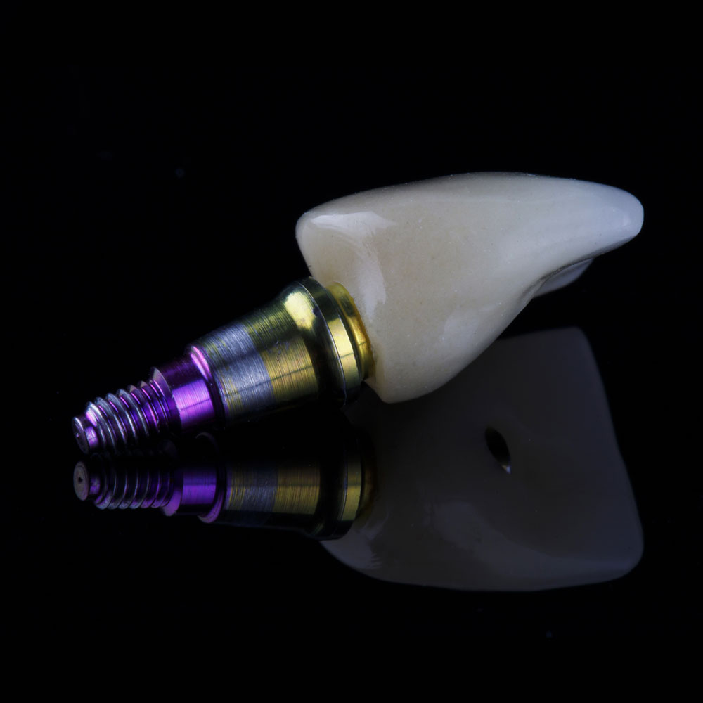 golden-dental-lab_services_implants-custom-abutments